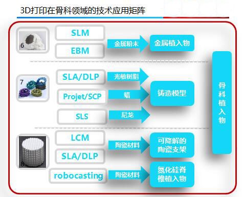 后路腰椎间融合器——Stryker的产业化之路