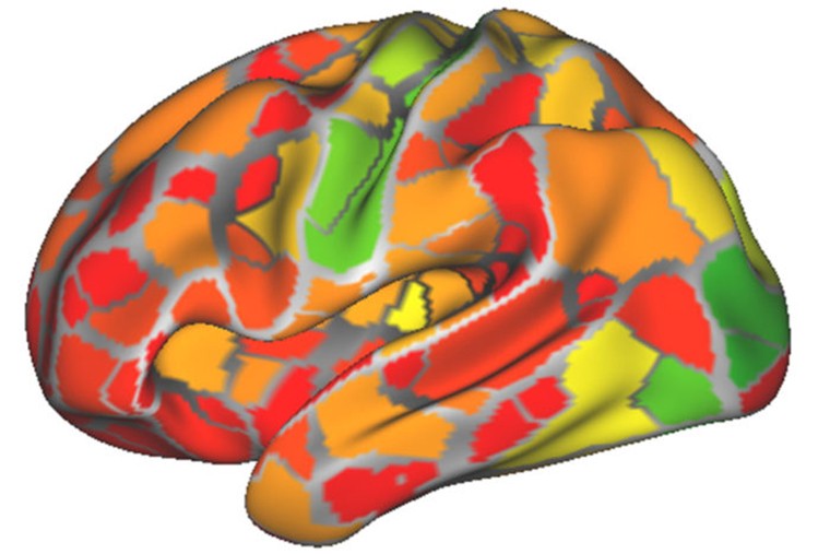 功能连接MRI扫描可以识别各种神经病症
