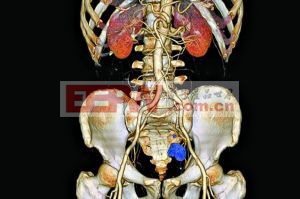 最新医学成像技术(组图)