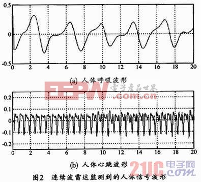 两个极大值是由于心房、心室呈现周期性收缩、舒张所引起的