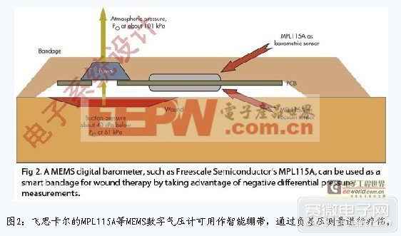 飞思卡尔的MPL115A等MEMS数字气压计可用作智能绷带，通过负差压测量进行疗伤